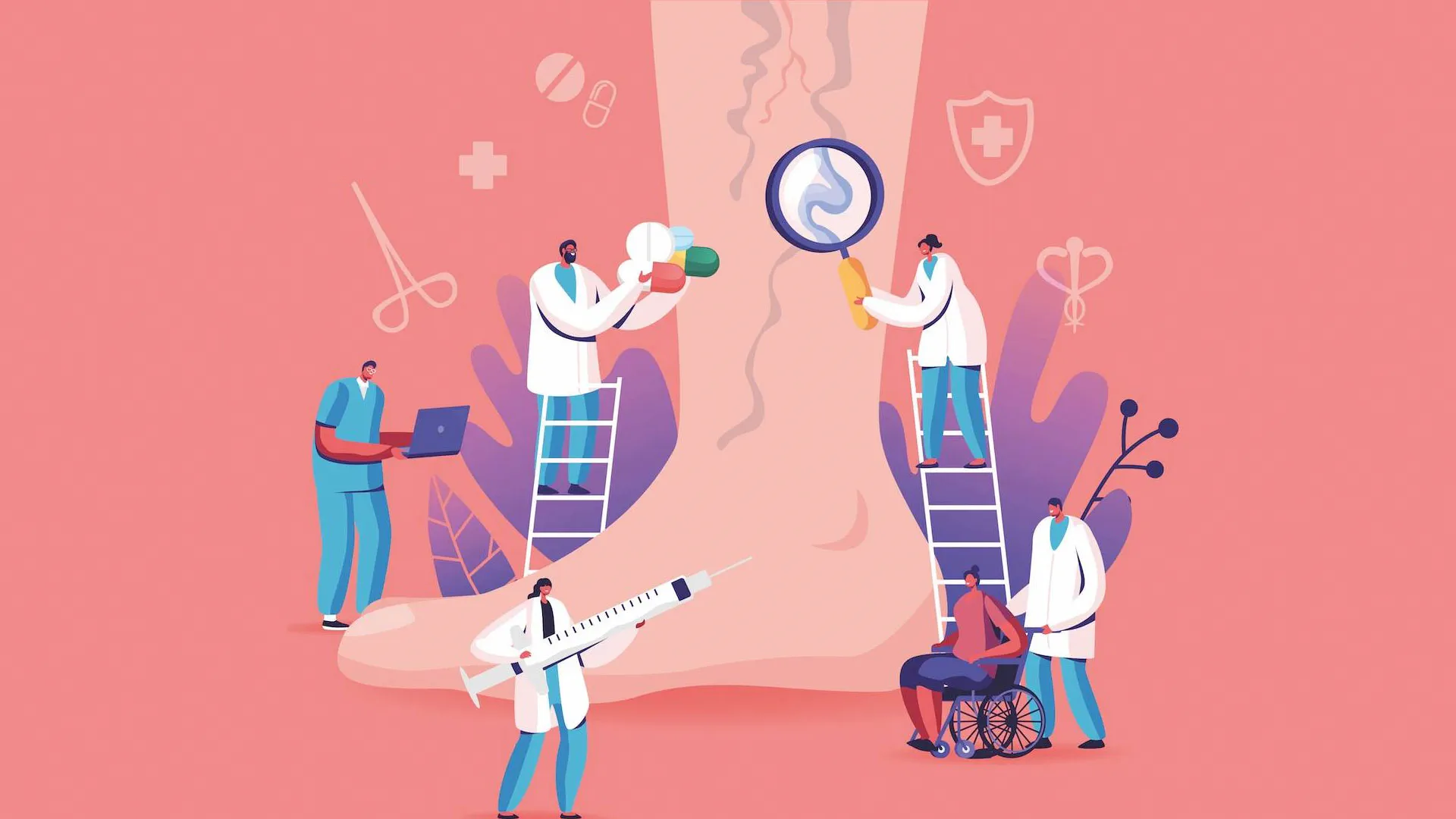 Visszérproblémák megelőzése és kezelése